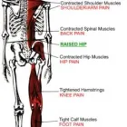 Business 1 image ADVANCE UPPER CERVICAL CHIROPRACTIC in Walnut Creek CA