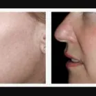 Business 1 image ALIZADEH COSMOPLASTIC SURGERY Clinical Research in New York NY