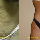 Business 4 image ALIZADEH COSMOPLASTIC SURGERY Clinical Research in New York NY