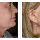 Business 6 image ALIZADEH COSMOPLASTIC SURGERY Clinical Research in New York NY