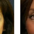 Business 7 image ALIZADEH COSMOPLASTIC SURGERY Clinical Research in New York NY
