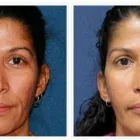 Business 8 image ALIZADEH COSMOPLASTIC SURGERY Clinical Research in New York NY