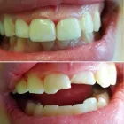Business 9 image ARDEN DENTAL SERVICES, P.C. Oral & Maxillofacial Surgeons in Brooklyn NY