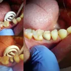 Business 11 image ARDEN DENTAL SERVICES, P.C. Oral & Maxillofacial Surgeons in Brooklyn NY
