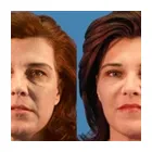 Business 5 image AVANTE PLASTIC SURGERY Tummy Tuck in Houston TX