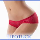 Business 2 image AVANTE PLASTIC SURGERY Tummy Tuck in Houston TX