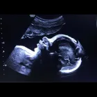 Business 1 image BEFORE WE MEET LLC Radiology & Medical Imaging in King Of Prussia PA