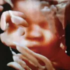 Business 2 image BEFORE WE MEET LLC Radiology & Medical Imaging in King Of Prussia PA
