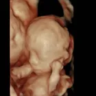 Business 3 image BEFORE WE MEET LLC Radiology & Medical Imaging in King Of Prussia PA