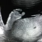Business 10 image BEFORE WE MEET LLC Radiology & Medical Imaging in King Of Prussia PA