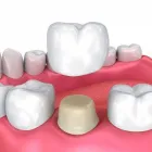 Business 15 image BERGER DENTAL GROUP Dentist in Columbia SC