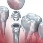 Business 19 image BERGER DENTAL GROUP Dentist in Columbia SC