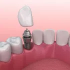 Business 29 image BERGER DENTAL GROUP Dentist in Columbia SC