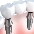 Business 2 image BEST DENTAL Dentists in Richmond TX