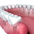 Business 3 image BEST DENTAL Dentists in Richmond TX