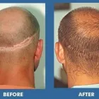 Business 3 image BEST PERMANENT MAKEUP BY JEFFERY LYLE SEGAL Permanent Makeup Clinic in Chicago IL