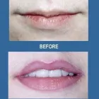 Business 5 image BEST PERMANENT MAKEUP BY JEFFERY LYLE SEGAL Permanent Makeup Clinic in Chicago IL