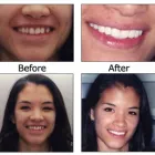 Business 1 image BIG SMILE DENTAL Teeth Whitening in Chicago IL