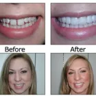 Business 2 image BIG SMILE DENTAL Teeth Whitening in Chicago IL