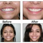 Business 4 image BIG SMILE DENTAL Teeth Whitening in Chicago IL