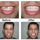 Business 5 image BIG SMILE DENTAL Teeth Whitening in Chicago IL