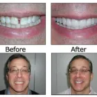 Business 6 image BIG SMILE DENTAL Teeth Whitening in Chicago IL