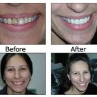 Business 8 image BIG SMILE DENTAL Teeth Whitening in Chicago IL