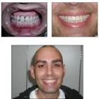 Business 9 image BIG SMILE DENTAL Teeth Whitening in Chicago IL