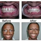 Business 11 image BIG SMILE DENTAL Teeth Whitening in Chicago IL