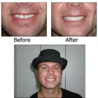 Business 12 image BIG SMILE DENTAL Teeth Whitening in Chicago IL