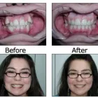 Business 13 image BIG SMILE DENTAL Teeth Whitening in Chicago IL