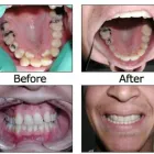 Business 14 image BIG SMILE DENTAL Teeth Whitening in Chicago IL