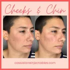 Business 4 image CHADWICK STEENDAM, PA-C Aesthetics in Richmond VA