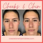 Business 5 image CHADWICK STEENDAM, PA-C Aesthetics in Richmond VA