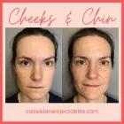 Business 6 image CHADWICK STEENDAM, PA-C Aesthetics in Richmond VA