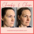 Business 7 image CHADWICK STEENDAM, PA-C Aesthetics in Richmond VA