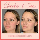 Business 8 image CHADWICK STEENDAM, PA-C Aesthetics in Richmond VA
