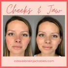 Business 17 image CHADWICK STEENDAM, PA-C Aesthetics in Richmond VA