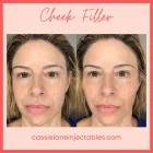 Business 19 image CHADWICK STEENDAM, PA-C Aesthetics in Richmond VA