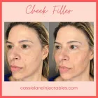 Business 20 image CHADWICK STEENDAM, PA-C Aesthetics in Richmond VA