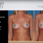 Business 1 image CHICAGO BREAST & BODY AESTHETICS Tattoo Removal in Chicago IL