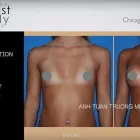 Business 3 image CHICAGO BREAST & BODY AESTHETICS Tattoo Removal in Chicago IL