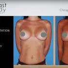 Business 4 image CHICAGO BREAST & BODY AESTHETICS Tattoo Removal in Chicago IL