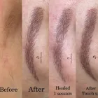 Business 4 image CHICAGO MICROBLADING STUDIO Permanent Make-Up Clinic in Chicago IL