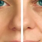 Business 5 image CHICAGO VEIN CARE CENTER - VARICOSE & SPIDER VEIN TREATMENT Vein Doctor in Chicago IL