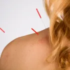 Business 8 image CITY ACUPUNCTURE FULTON STREET Acupuncture in New York NY
