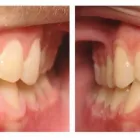 Business 4 image CLEAR SMILES Dental Technicians & Laboratories in Dallas TX