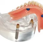Business 2 image COMFY DENTURE & HEARING Dentists & Dental Clinics in Federal Way WA