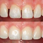 Business 3 image CURTIS J. PERRY DDS Teeth Whitening Service in Oakland CA