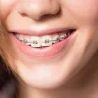 Business 34 image DELGADO ORTHODONTICS Orthodontists in North Richland Hills TX